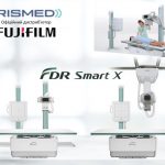 Преимущества стационарного рентгена FDR Smart X